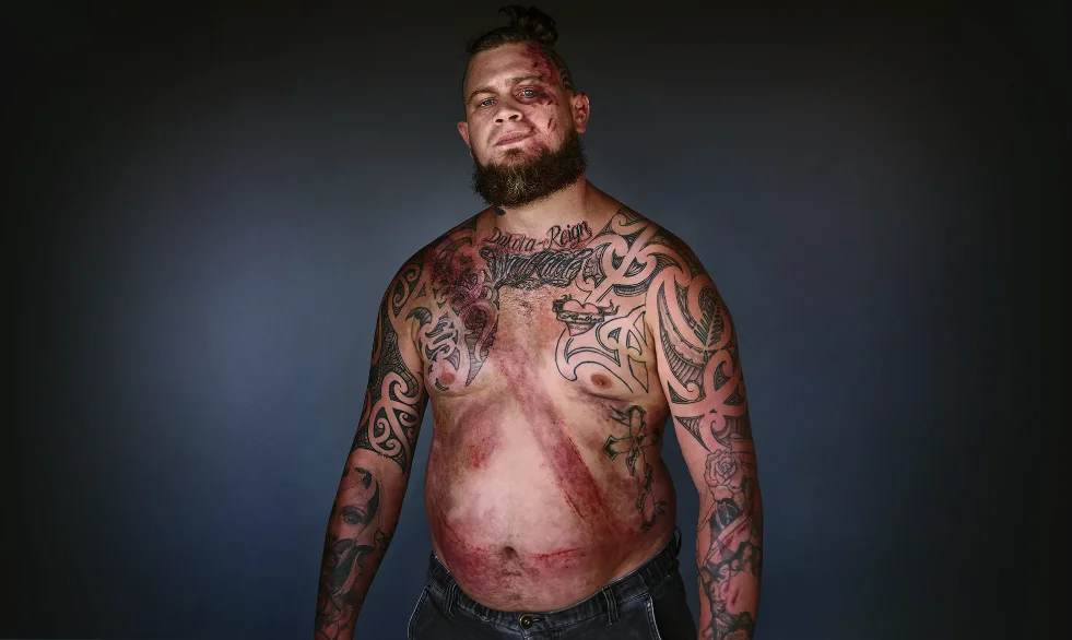 Выживший в ДТП-1